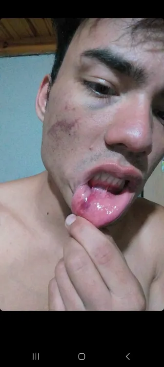 denuncia agresión policial3