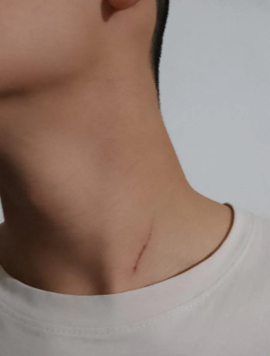 corte en el cuello