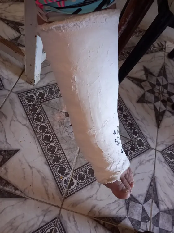 accidentada3