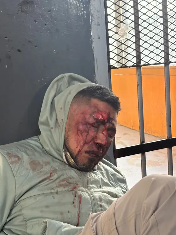 detenido operativo cerrojo