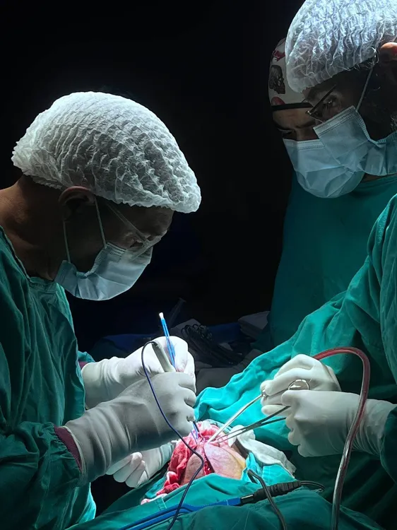 operación de lengua (3)