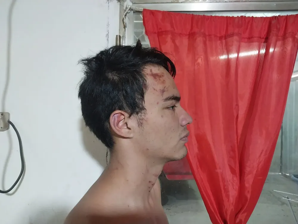 denuncia agresión policial2